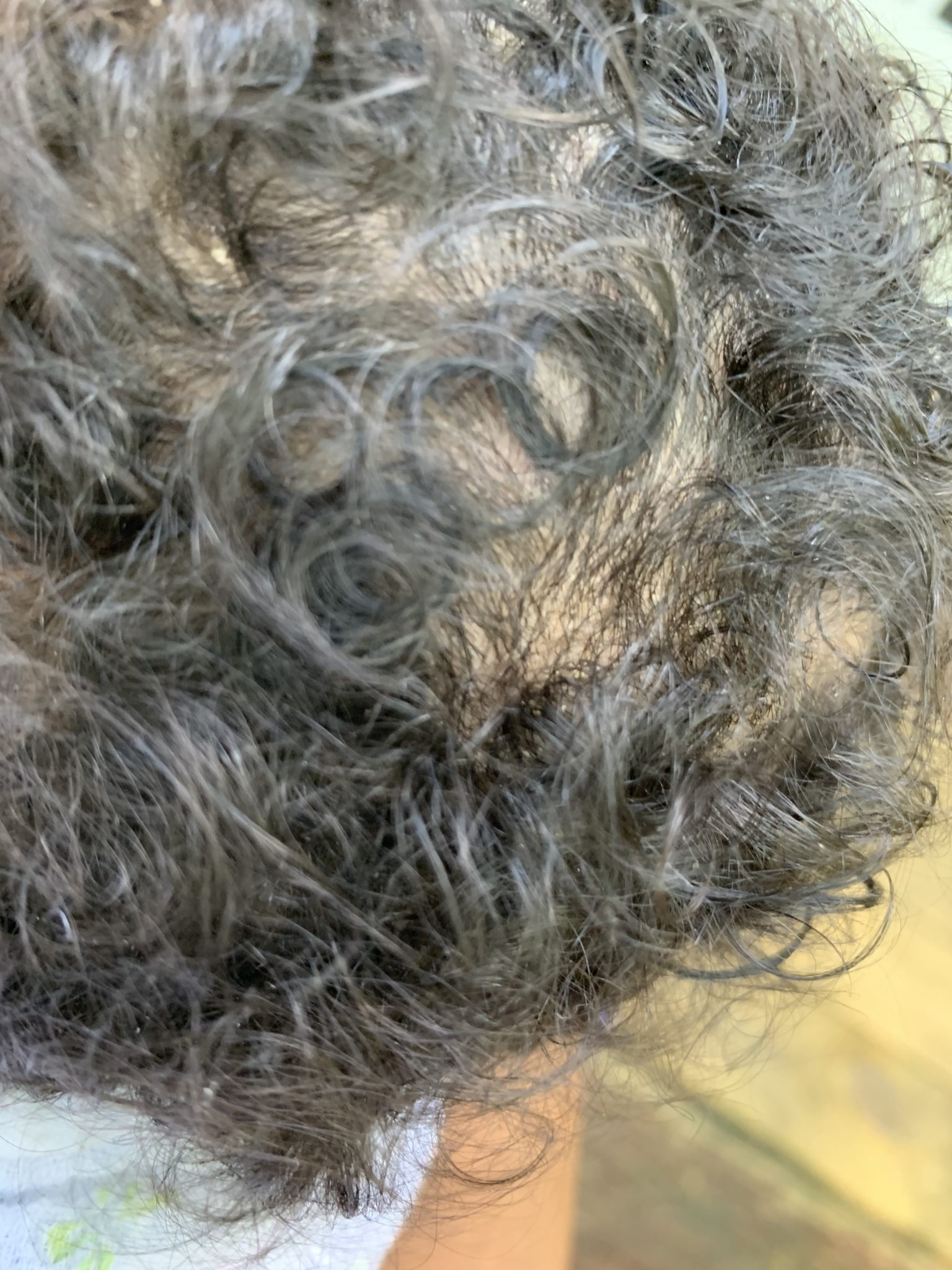 Natural Cradle Cap Remedy Breast milk and Coconut Oil Serene Mom Life